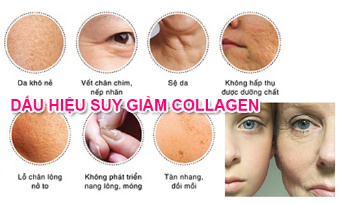 Dấu hiệu suy giảm Collagen theo thời gian